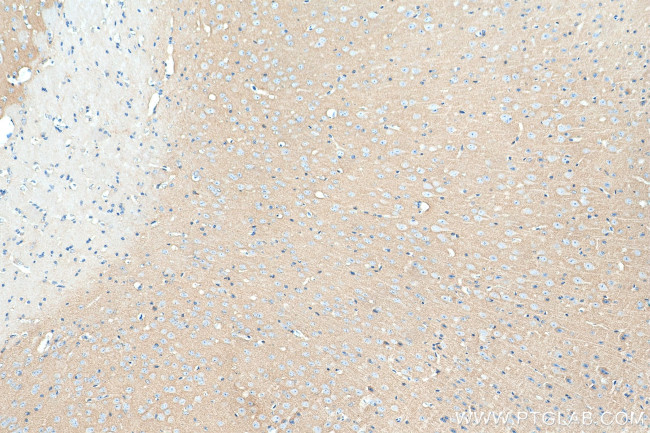 SYN1 Antibody in Immunohistochemistry (Paraffin) (IHC (P))