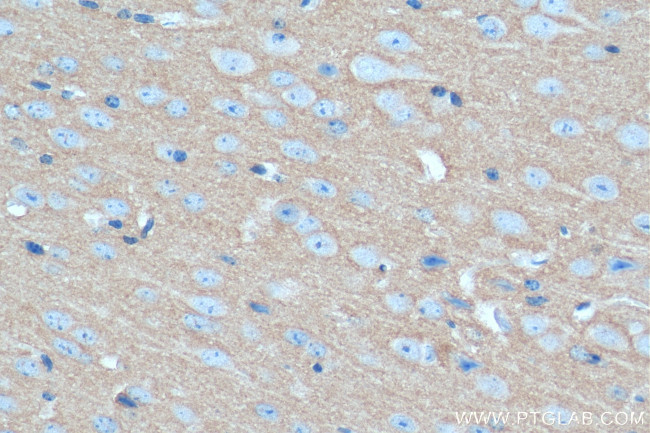 SYN1 Antibody in Immunohistochemistry (Paraffin) (IHC (P))