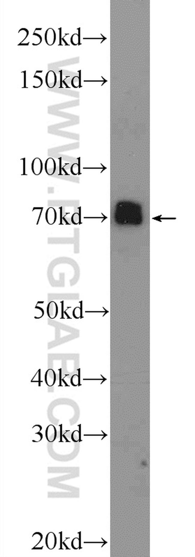 SYN1 Antibody in Western Blot (WB)