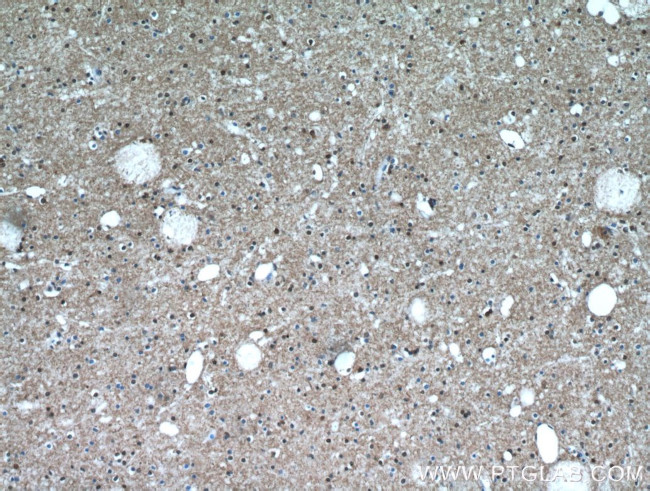 TAF1 Antibody in Immunohistochemistry (Paraffin) (IHC (P))