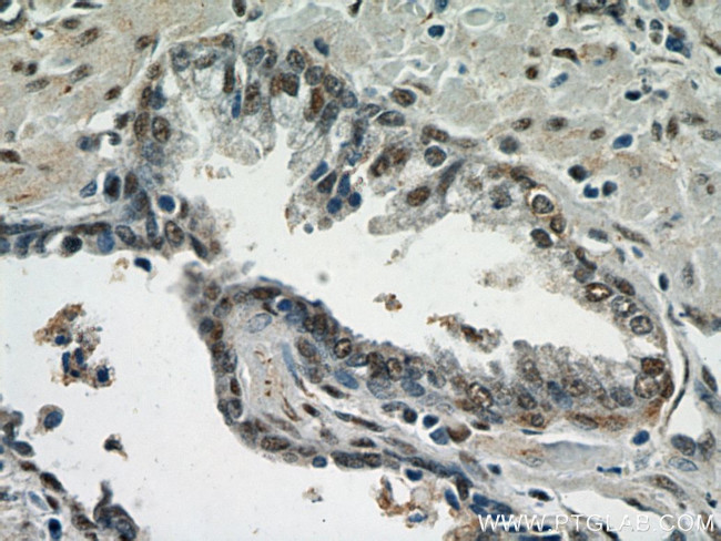 TAF1 Antibody in Immunohistochemistry (Paraffin) (IHC (P))