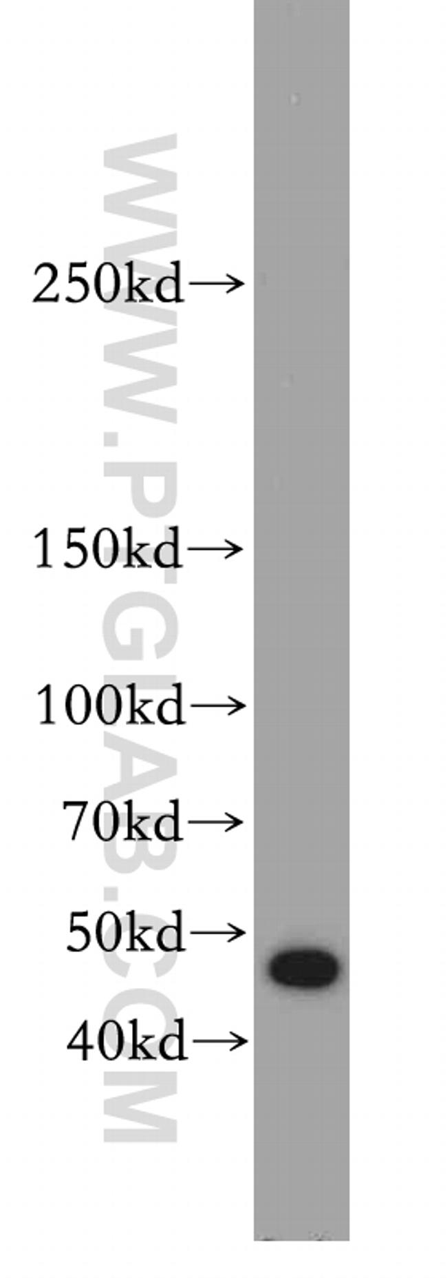 TAF1 Antibody in Western Blot (WB)