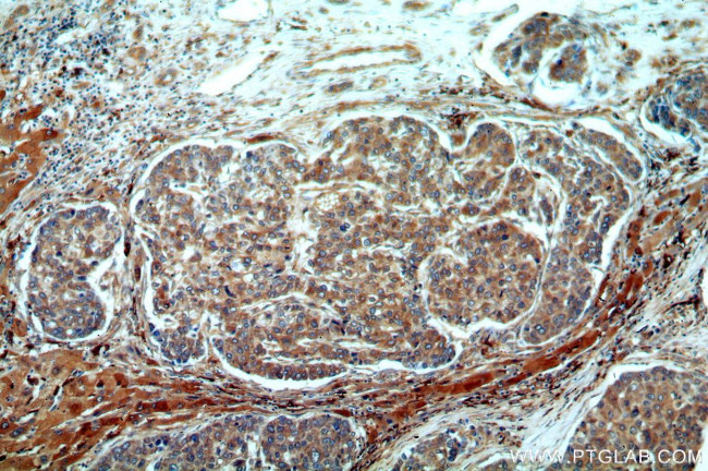 SERINC1 Antibody in Immunohistochemistry (Paraffin) (IHC (P))