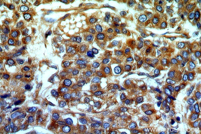 SERINC1 Antibody in Immunohistochemistry (Paraffin) (IHC (P))