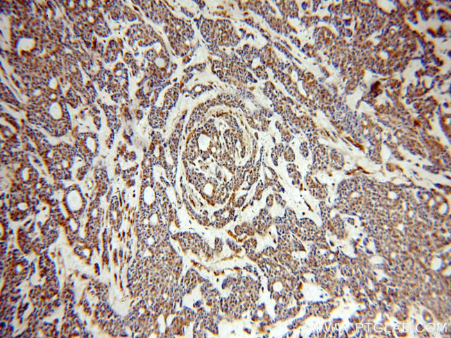 SERINC1 Antibody in Immunohistochemistry (Paraffin) (IHC (P))