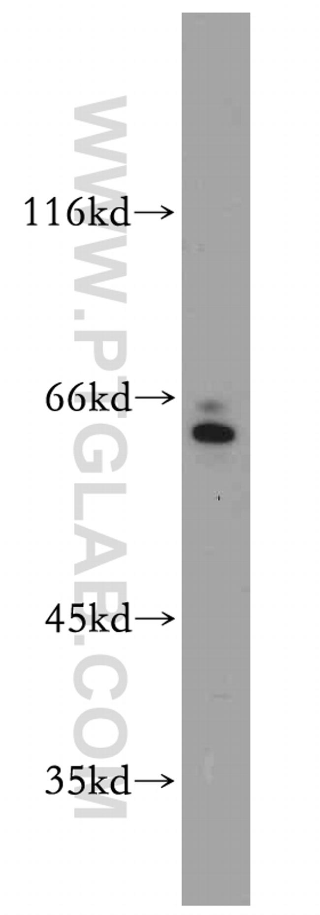 SERINC2 Antibody in Western Blot (WB)