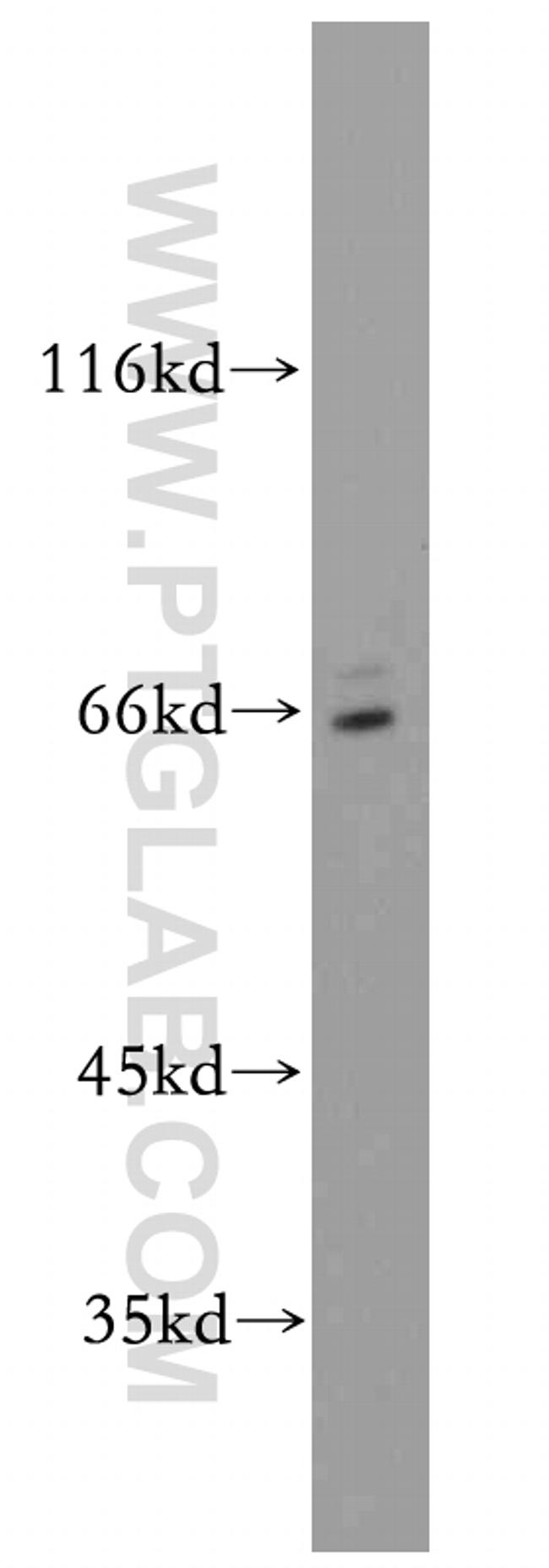 SERINC2 Antibody in Western Blot (WB)