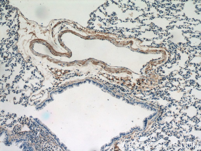 Osteocalcin Antibody in Immunohistochemistry (Paraffin) (IHC (P))