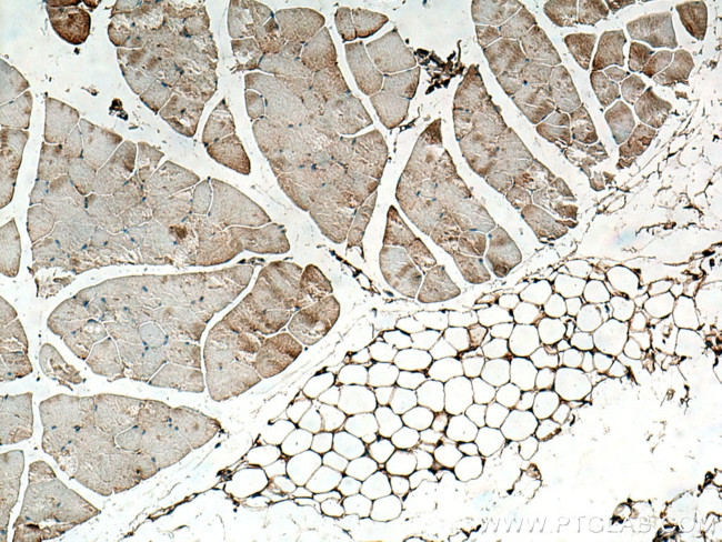 Osteocalcin Antibody in Immunohistochemistry (Paraffin) (IHC (P))