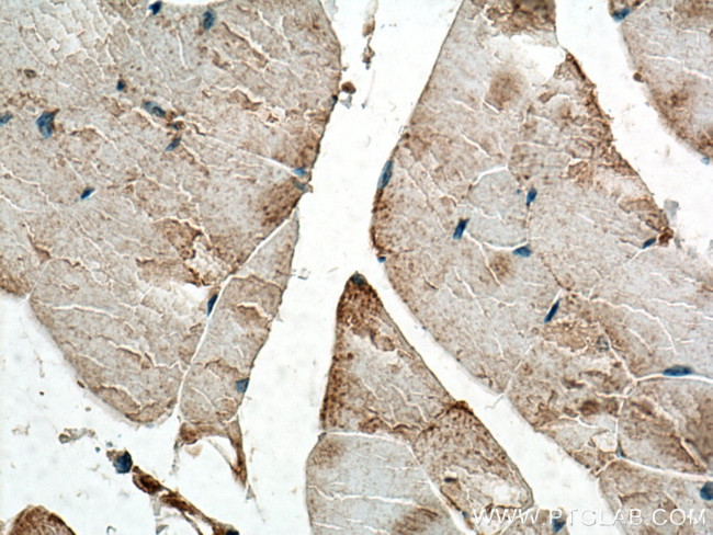 Osteocalcin Antibody in Immunohistochemistry (Paraffin) (IHC (P))