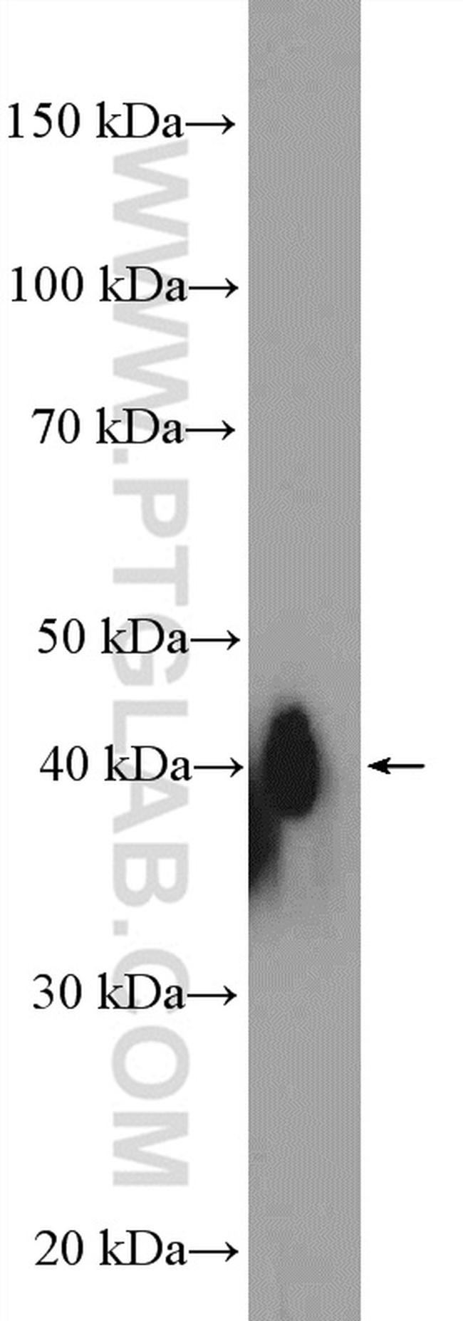 XRCC2 Antibody in Western Blot (WB)