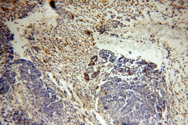 MLN64 Antibody in Immunohistochemistry (Paraffin) (IHC (P))