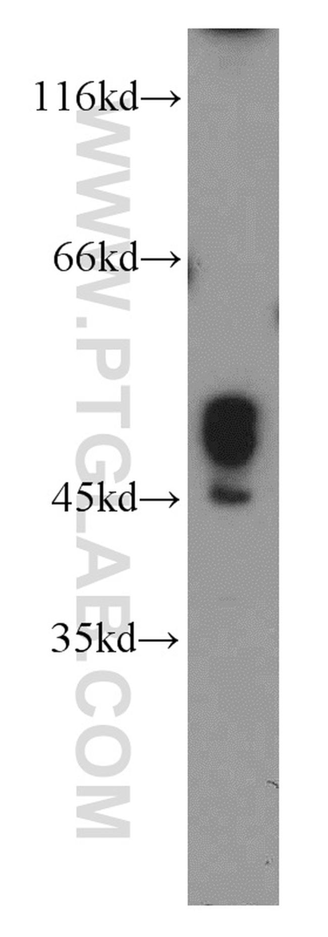 MLN64 Antibody in Western Blot (WB)