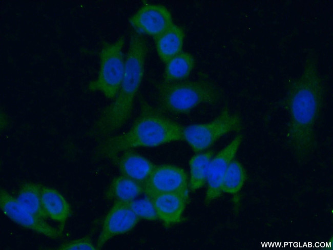 MLN64 Antibody in Immunocytochemistry (ICC/IF)