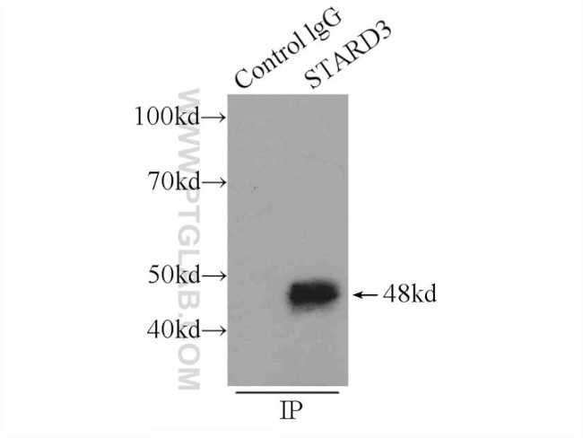 MLN64 Antibody in Immunoprecipitation (IP)