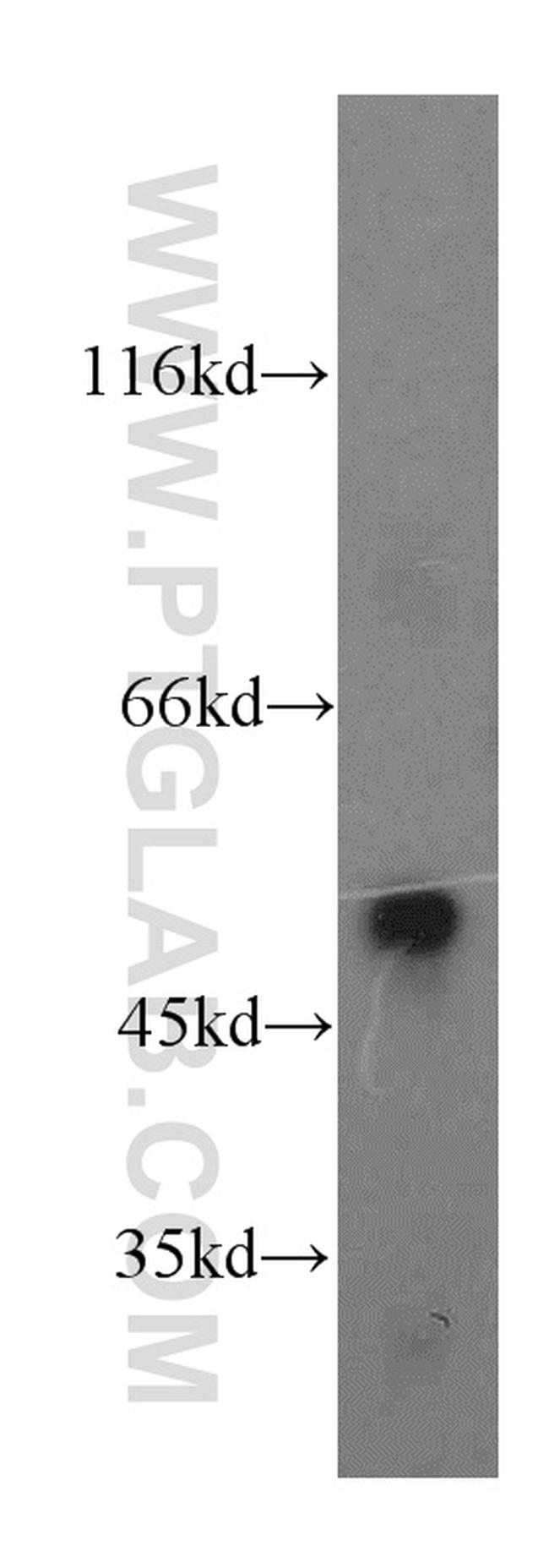 MLN64 Antibody in Western Blot (WB)