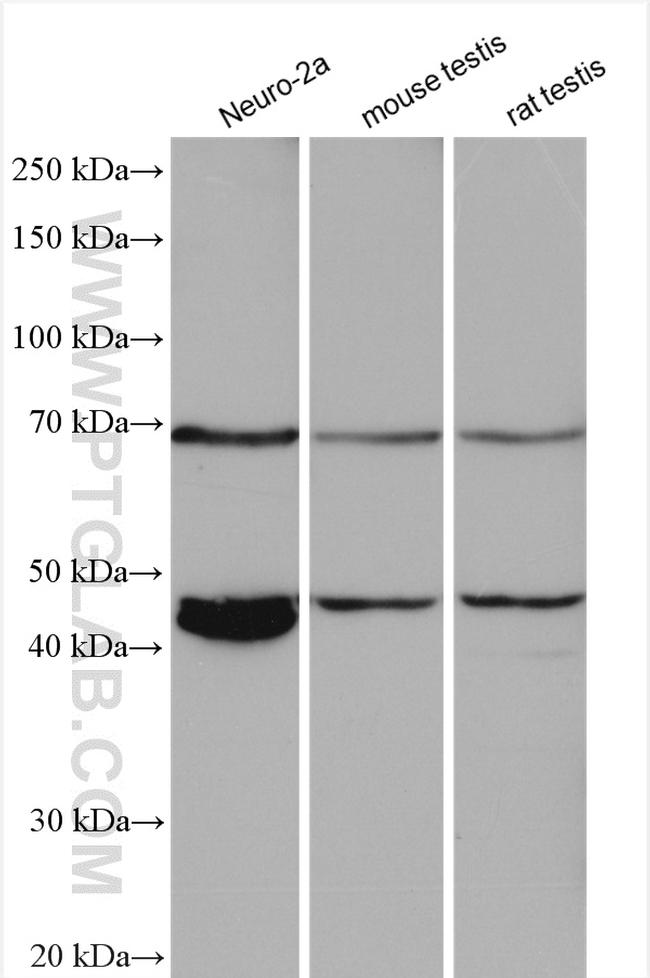 GAT1 Antibody in Western Blot (WB)