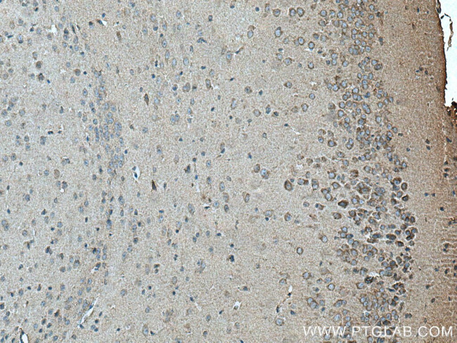 SLC6A8 Antibody in Immunohistochemistry (Paraffin) (IHC (P))