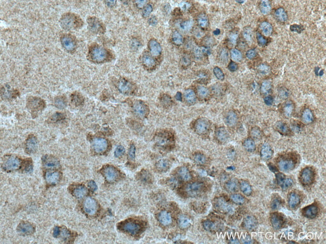 SLC6A8 Antibody in Immunohistochemistry (Paraffin) (IHC (P))