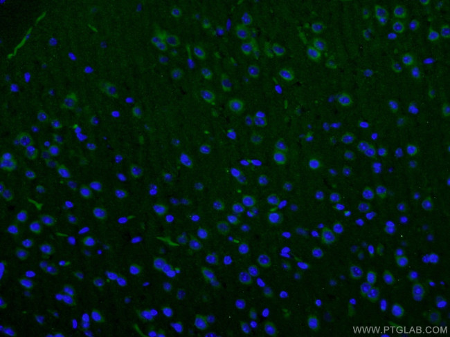 SLC6A8 Antibody in Immunohistochemistry (PFA fixed) (IHC (PFA))