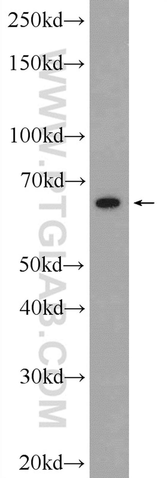 SLC6A8 Antibody in Western Blot (WB)