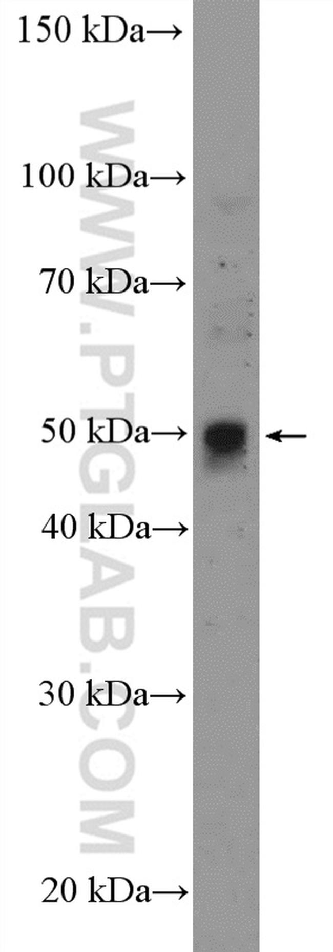 ANKH Antibody in Western Blot (WB)