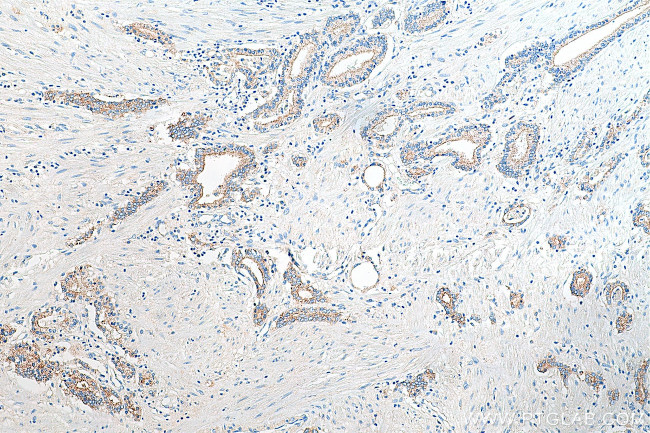 CD47 Antibody in Immunohistochemistry (Paraffin) (IHC (P))