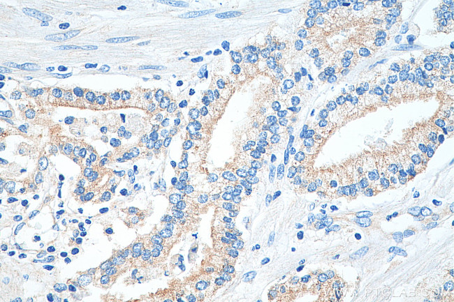 CD47 Antibody in Immunohistochemistry (Paraffin) (IHC (P))