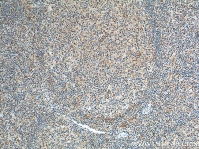 GPR65 Antibody in Immunohistochemistry (Paraffin) (IHC (P))