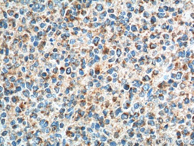 GPR65 Antibody in Immunohistochemistry (Paraffin) (IHC (P))