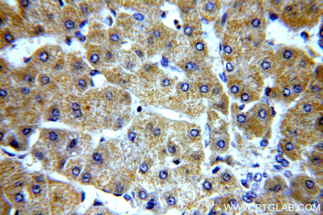 ELOVL2 Antibody in Immunohistochemistry (Paraffin) (IHC (P))