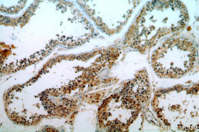 ELOVL2 Antibody in Immunohistochemistry (Paraffin) (IHC (P))