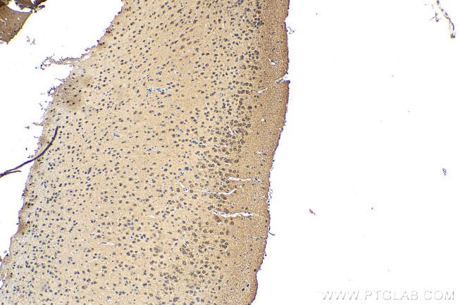 DRD5 Antibody in Immunohistochemistry (Paraffin) (IHC (P))