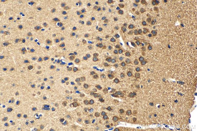 DRD5 Antibody in Immunohistochemistry (Paraffin) (IHC (P))