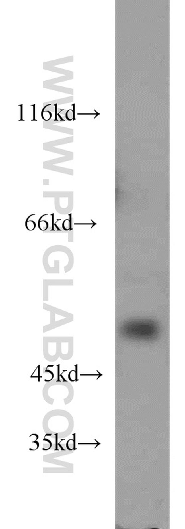 DRD5 Antibody in Western Blot (WB)