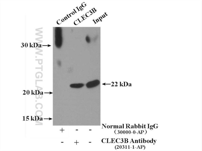 CLEC3B Antibody in Immunoprecipitation (IP)