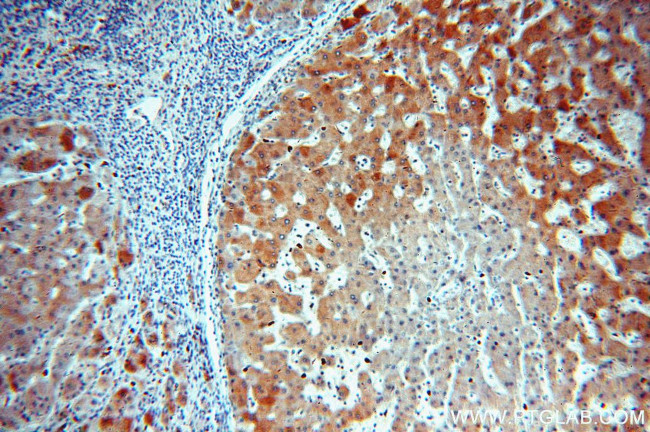 NDUFA9 Antibody in Immunohistochemistry (Paraffin) (IHC (P))