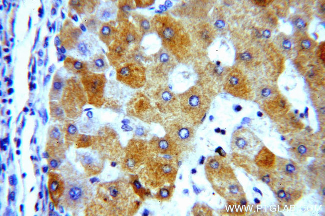 NDUFA9 Antibody in Immunohistochemistry (Paraffin) (IHC (P))