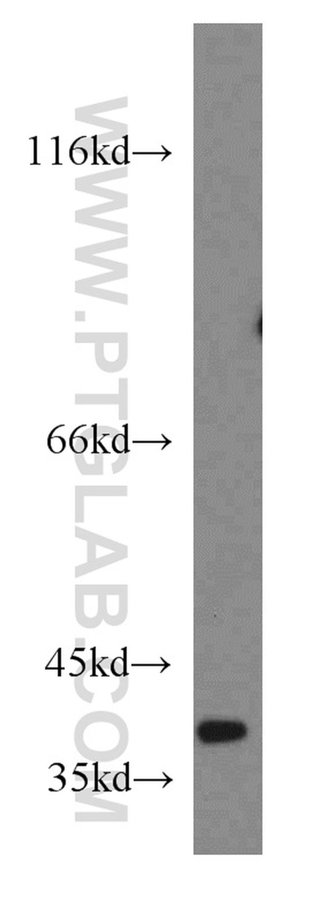 NDUFA9 Antibody in Western Blot (WB)