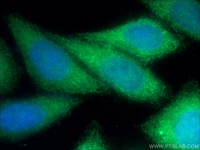 GBE1 Antibody in Immunocytochemistry (ICC/IF)