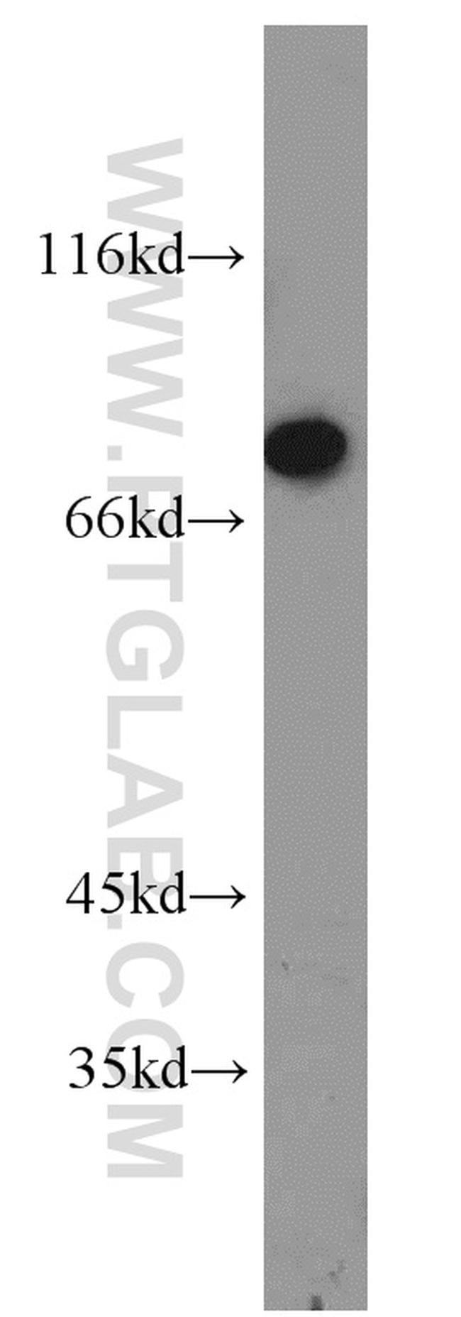 GBE1 Antibody in Western Blot (WB)