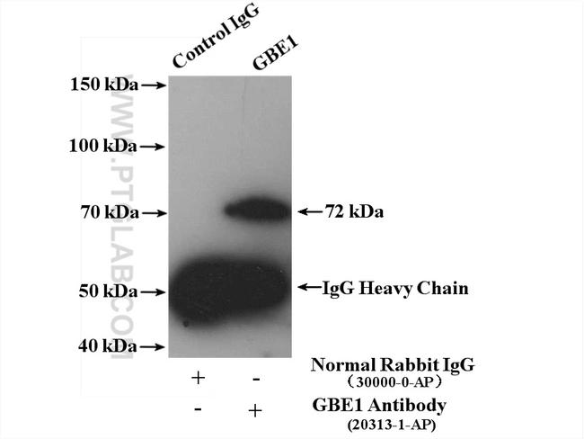 GBE1 Antibody in Western Blot (WB)