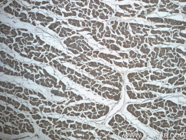 MEF2C Antibody in Immunohistochemistry (Paraffin) (IHC (P))