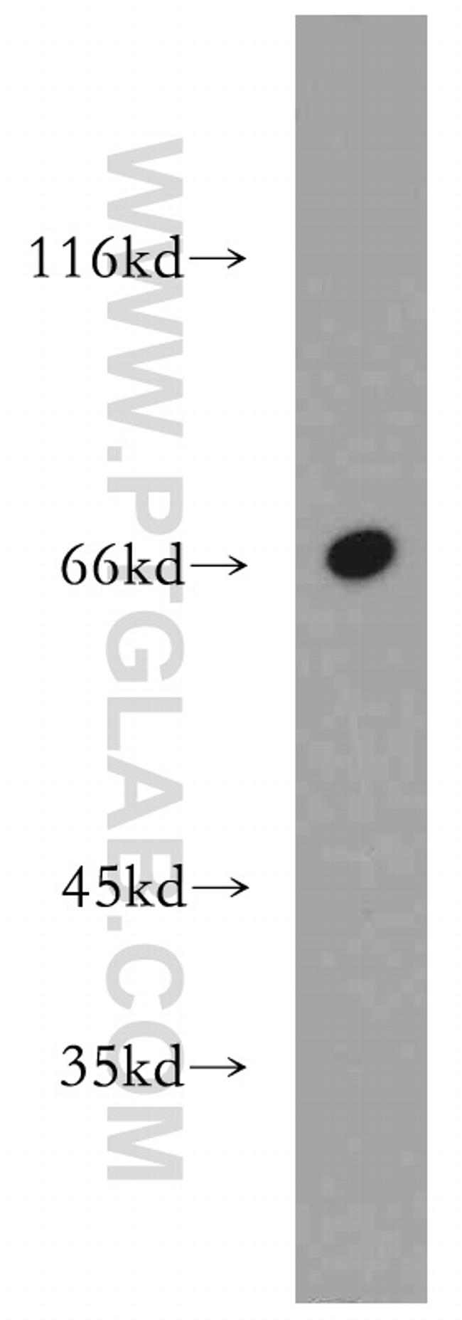 MEF2C Antibody in Western Blot (WB)