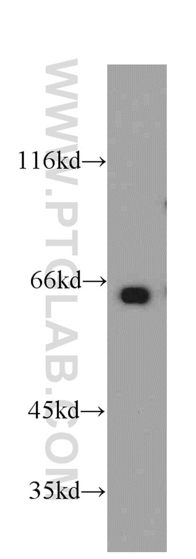 MEF2C Antibody in Western Blot (WB)