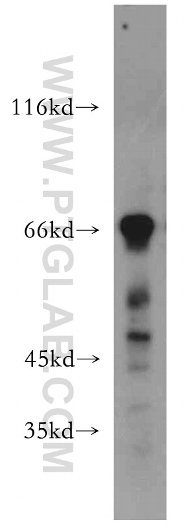 MEF2C Antibody in Western Blot (WB)