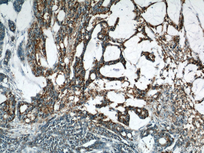 B4GALT2 Antibody in Immunohistochemistry (Paraffin) (IHC (P))