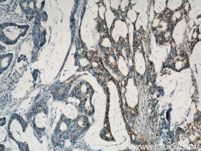 B4GALT2 Antibody in Immunohistochemistry (Paraffin) (IHC (P))