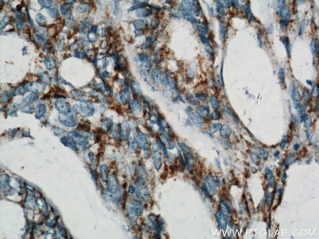 B4GALT2 Antibody in Immunohistochemistry (Paraffin) (IHC (P))