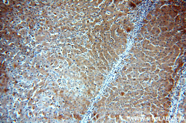 LTBR Antibody in Immunohistochemistry (Paraffin) (IHC (P))